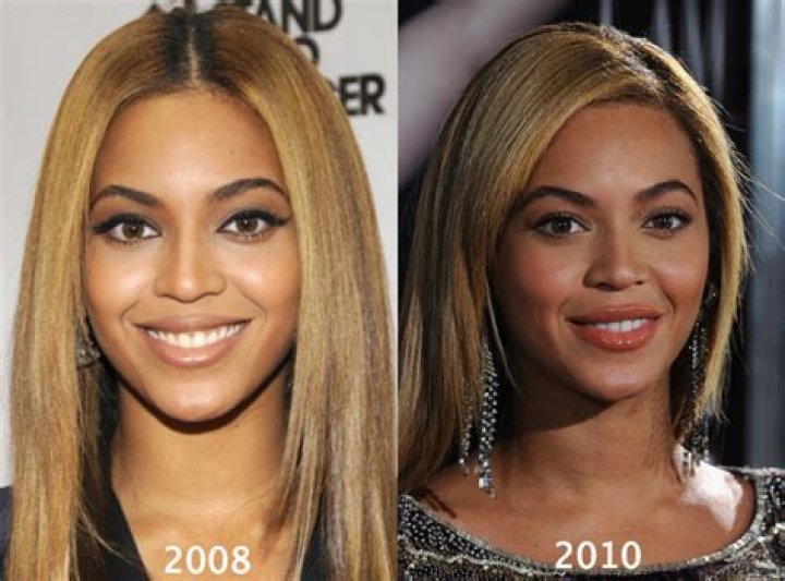 Beyonce Breast Implants Plastic Surgery Before and After Celebie