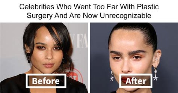 Beyonc&eacute; Plastic Surgery Did the Singer Lighten Her Skin?