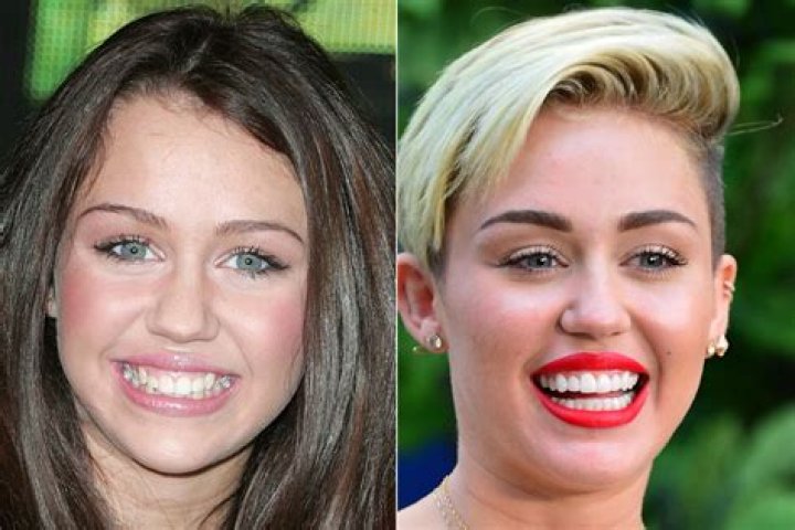 Celebs With The Worst Teeth