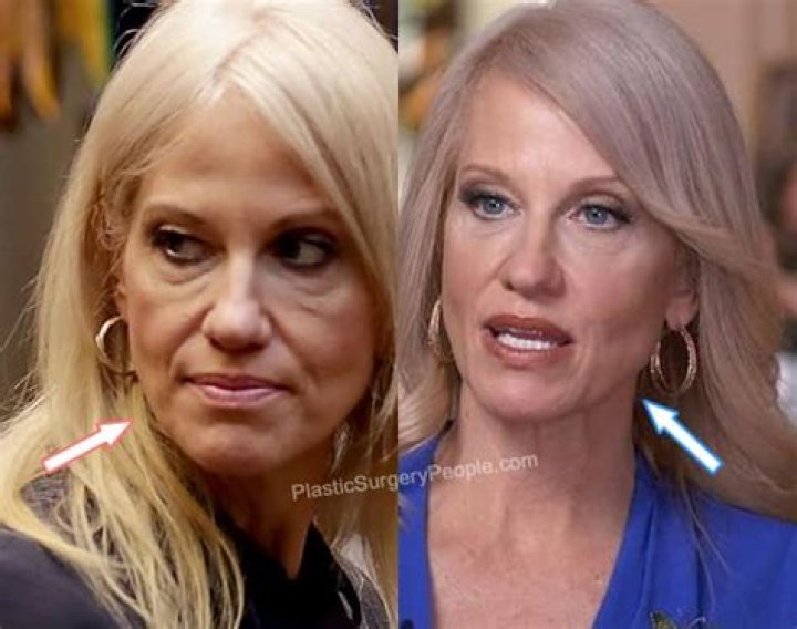 Conway Plastic Surgery Before and After