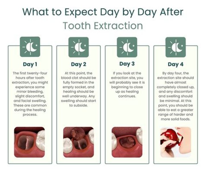 Day 3 after extractions and immediate Dentures YouTube