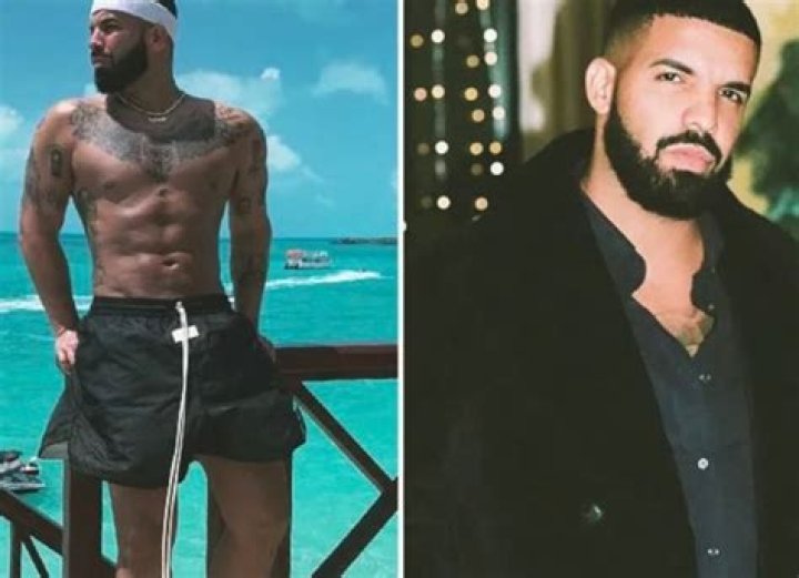 Drake Plastic Surgery Has The Rapper Obtained BBL and Lipo? Reddit