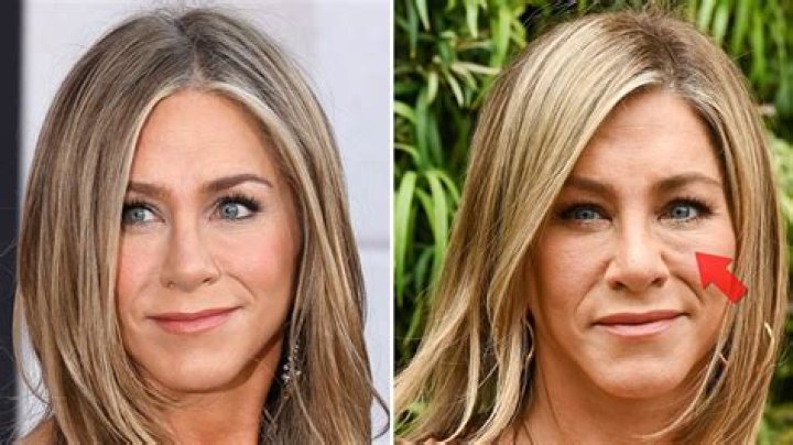 Has Jennifer Aniston Had Plastic Surgery? (Before & After 2018)
