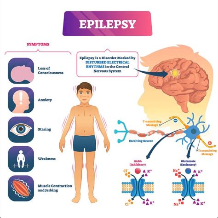 How Epilepsy Is Treated (2023)