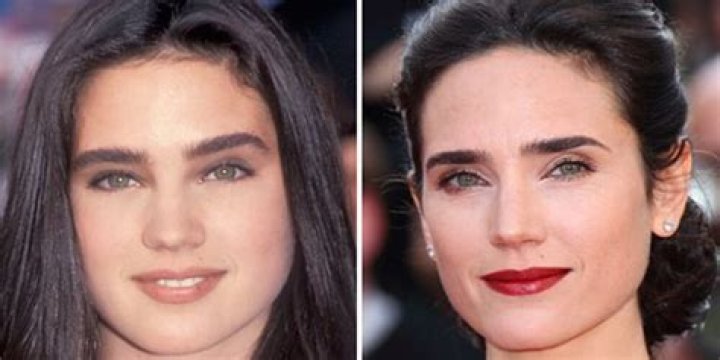 Jennifer Connelly Breast Reduction Plastic Surgery Before and After