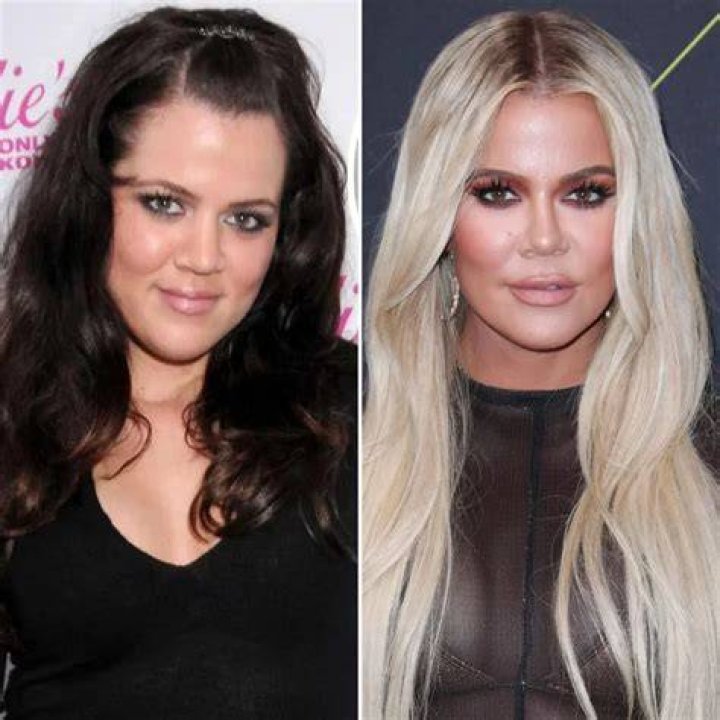 Khloe Kardashian Plastic Surgery Did She Get A Nose Job? Celeb Dirty