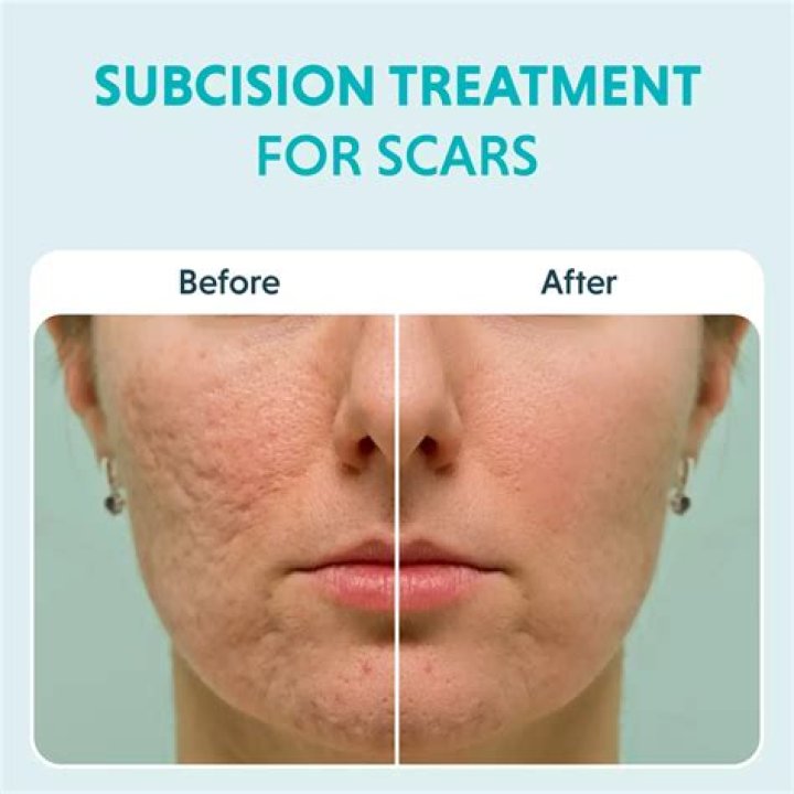 Living with facial scars in Nigeria