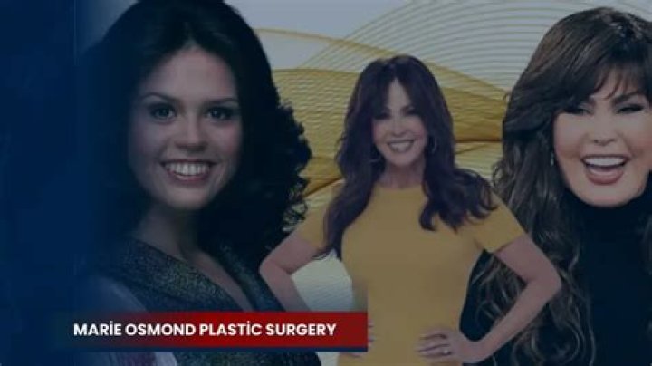 Marie Osmond Plastic Surgery: How She Maintains Her Youthful Looks