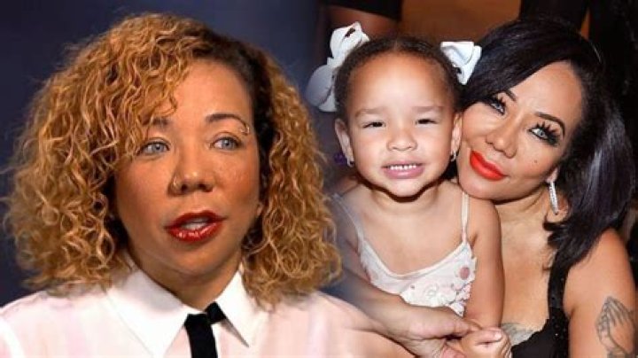 Tiny Harris Opens Up About Plastic Surgery History Plastic Surgery Notes